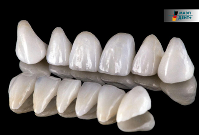 Реставрация кривых зубов