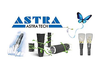 Преимущества имплантов AstraTech